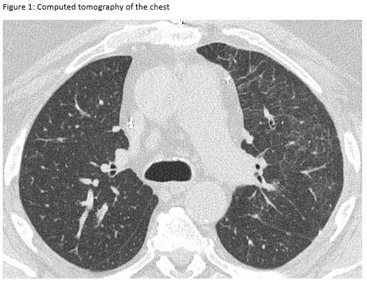 Computed Tomography