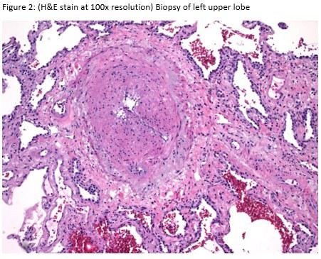 CT Angiography