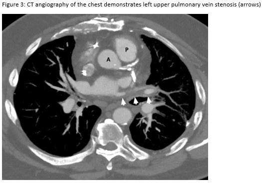 CT Angiogram