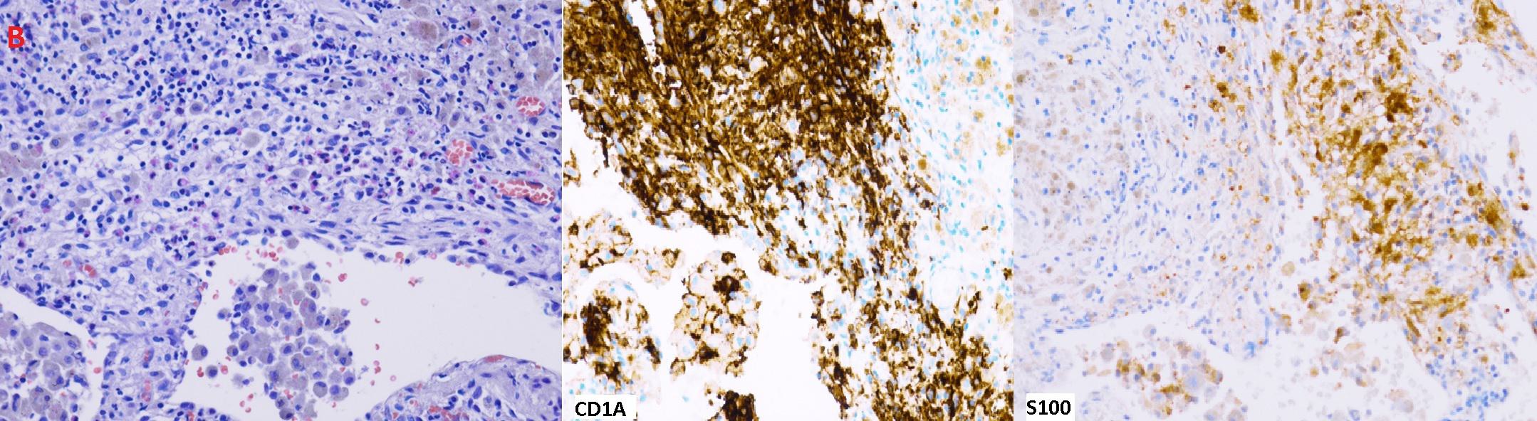American Thoracic Society | I Know It When I See It