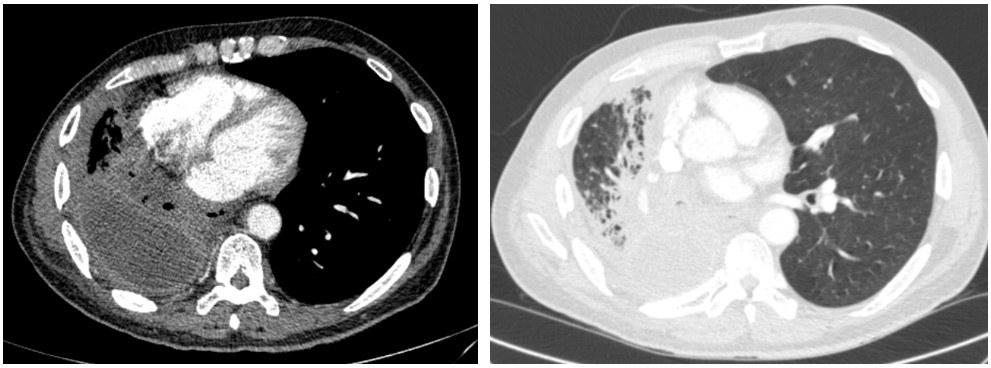 Computed Tomography